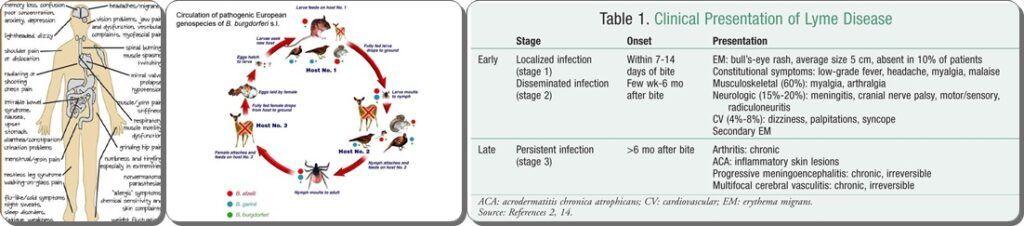 Lyme Disease_Symptoms