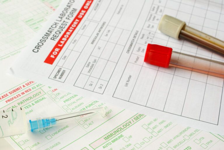 Lyme Disease Labs Lyme Disease Testing in Labs